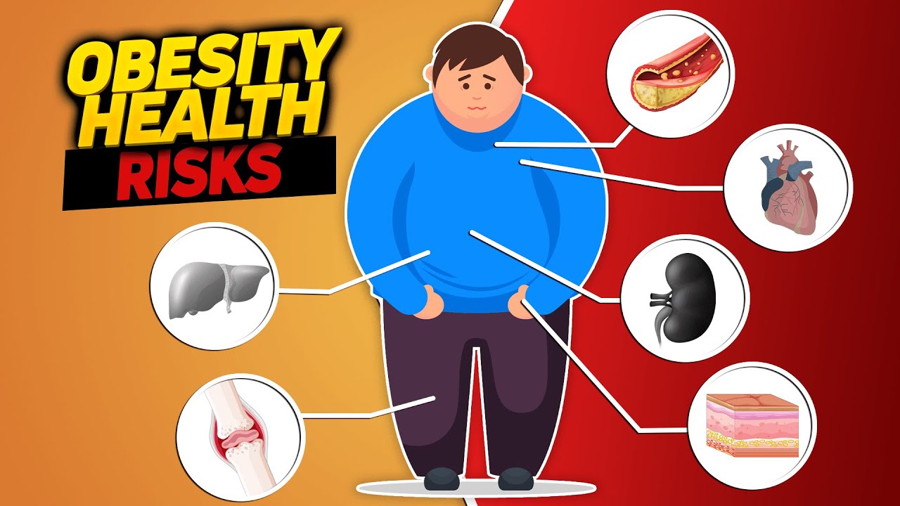 Obesity Health Risks or How Excessive Fat Destroys the Body