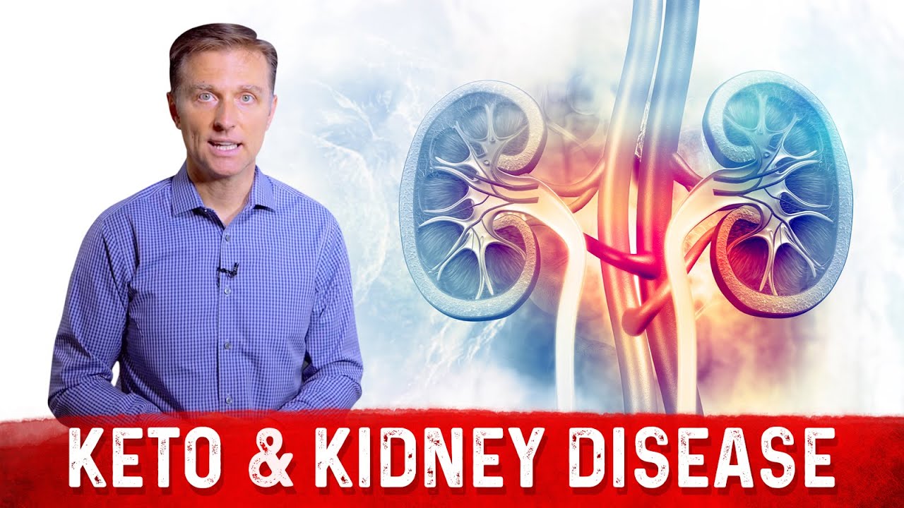 Keto Diet &amp; Kidney Disease – Dr. Berg