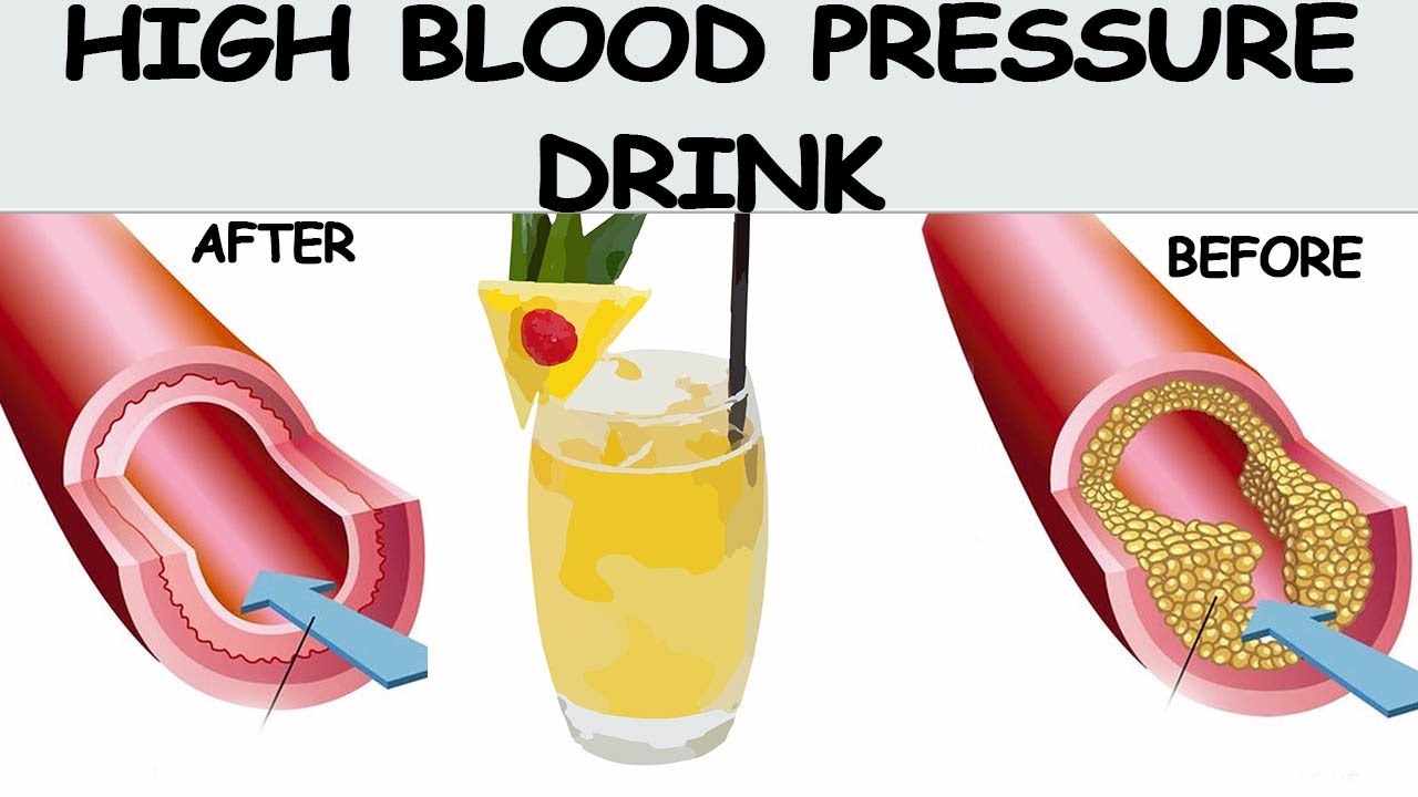 Drinks That Regulate High Blood Pressure &amp; Clean Arteries